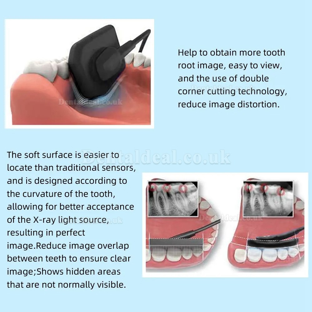 Dental Digital X-Ray Sensor RVG Dental Intraoral Imaging System